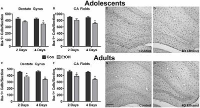 Microglia Dystrophy Following Binge-Like Alcohol Exposure in Adolescent and Adult Male Rats